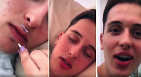 Uyuduğu Sırada Kız Arkadaşının Gazabına Uğrayıp Estetik Bir Görünüme Sahip Olan Genç