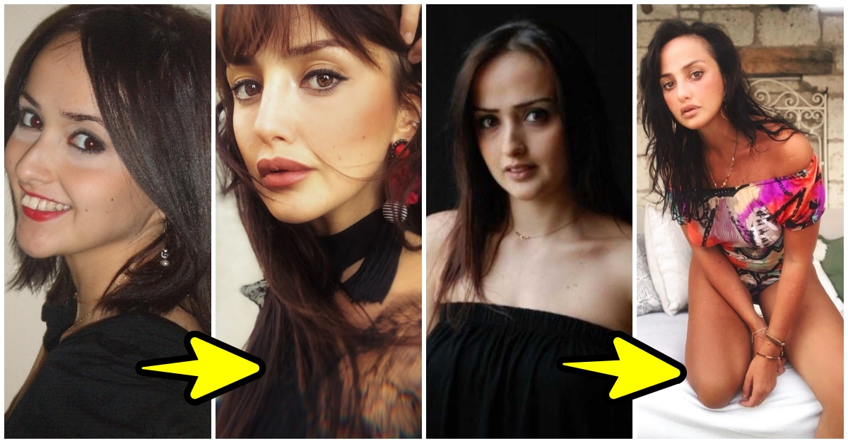 Küçük Estetik Müdahalelerin Bazen Çok İyi Sonuçlar Verebileceğini
