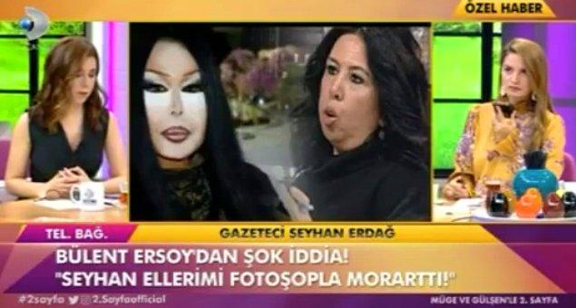 5. Bülent Ersoy ellerindeki morluklar nedeniyle Seyhan Erdağ'ı suçladı!