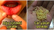 Hayatının Herhangi Bir Döneminde Diş Teli Kullananların Çok İyi Anlayacağı 23 Can Yakan Fotoğraf