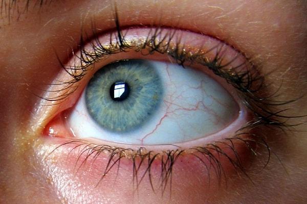 8. Gözünüzün üzerinde dolanan dalgalı şeylere "yüzerler" denir ve bu yüzerler gözlerimizin içindeki küçük protein ipliklerinin retinamıza yansımasıyla oluşurlar.