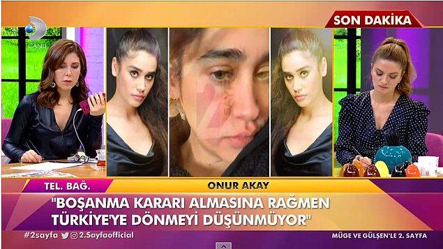 Fakat bugün bir magazin programına bağlanan Onur Akay, Meltem Miraloğlu'nun boşanmak istediğini söyledi!