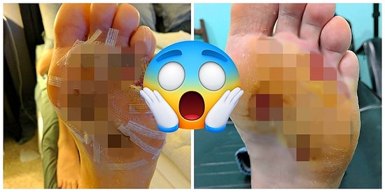 Yüzlerce Kişinin Kullandığı Fitness Salonu Duşlarına Niçin Çıplak Ayakla Girmemeliyiz?