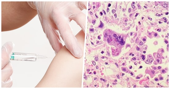 Alman Parlamentosu Onayladı: Çocuklarına Kızamık Aşısı Yaptırmayan Ailelere Para Cezası Verilecek