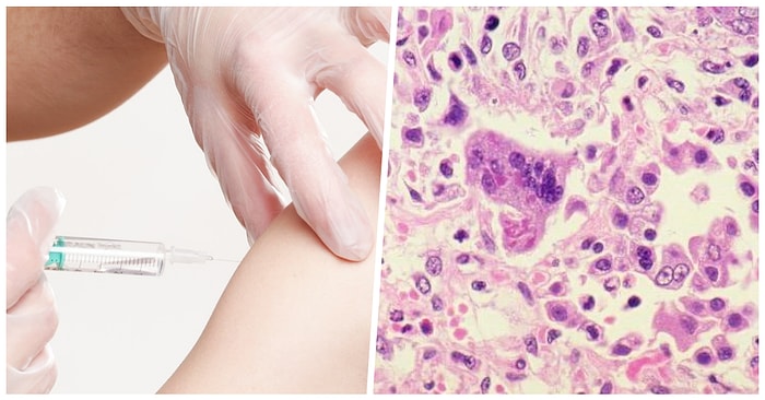 Alman Parlamentosu Onayladı: Çocuklarına Kızamık Aşısı Yaptırmayan Ailelere Para Cezası Verilecek