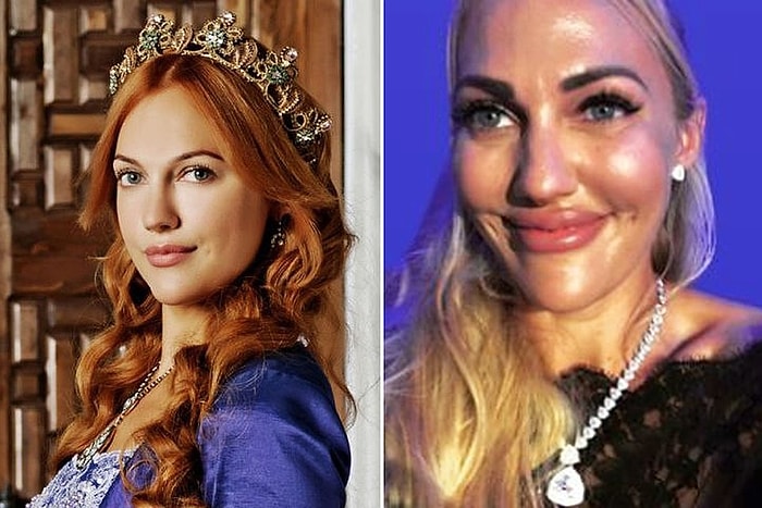 Что стало с внешностью турецкой актрисы Мерьем Узерли?
