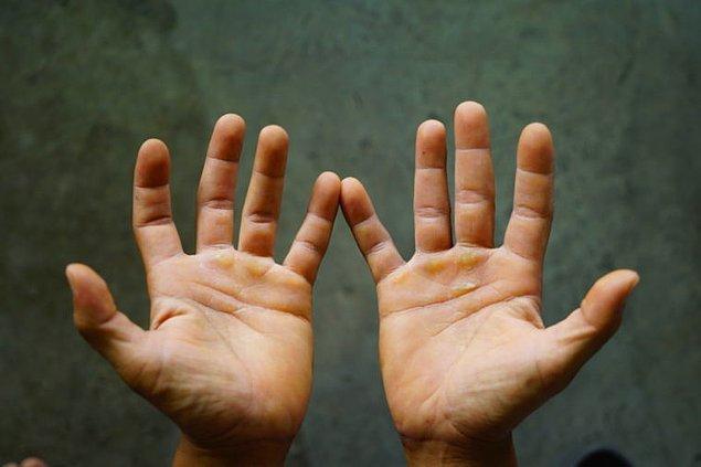 5. Beynimiz 6. bir parmağa sahip olmaya adapte olabilir.