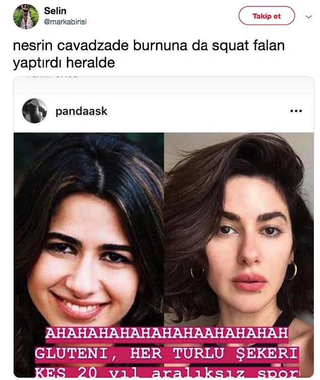 Nesrin Cavadzade'nin gluteni keserek yaptığı diyet sonucu yüzünde kendiliğinden oluşan estetik operasyonlar