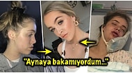 Alt Çenesi Çıkık Olduğu İçin Yıllarca Zorbalığa Maruz Kaldıktan Sonra Geçirdiği Ameliyatla Bambaşka Birine Dönüşen Kadın