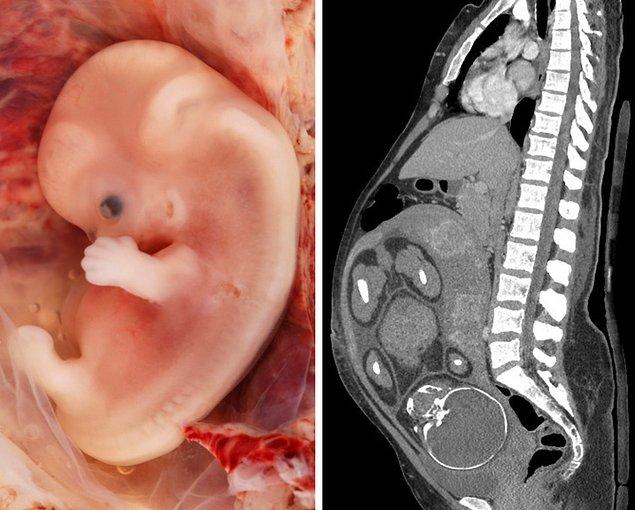 9. Bir fetüsün kök hücreleri, iyileşme ve gençleşmeyi desteklemek için doğum yaptıktan sonra annenin vücudunda kalır.