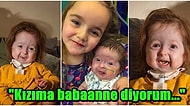 Dünya Üzerinde Sadece 2 Yaşındaki Isla Kilpatrick-Screaton'ın Sahip Olduğu 'Benjamin Button Hastalığı'