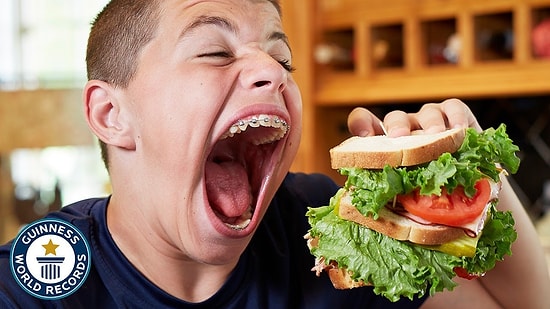 Dünyanın En Geniş Ağızlısı: 14 Yaşındaki Çocuk Ağzını 9.34 Santim Açabiliyor!