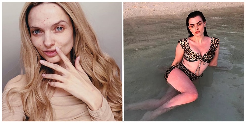 Modeller Kendinizi ve Bedeninizi Daha Çok Sevmenizi Sağlayacak Kusurlarını Paylaştılar!