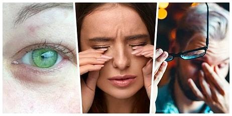 Göz Sağlığınızın Ciddi Bir Şekilde Tehlikede Olabileceğini Gösteren 10 İşaret