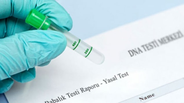 Gerçek DNA testi ile ortaya çıktı