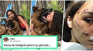 Köpek Tarafından Isırıldığı Anı ve Kesiklerini Paylaşan Genç Kadına Aynı Kaderi Paylaşan Kişilerden Gelen Cevaplar