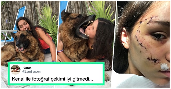 Köpek Tarafından Isırıldığı Anı ve Kesiklerini Paylaşan Genç Kadına Aynı Kaderi Paylaşan Kişilerden Gelen Cevaplar