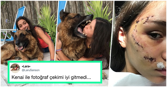 Köpek Tarafından Isırıldığı Anı ve Kesiklerini Paylaşan Genç Kadına Aynı Kaderi Paylaşan Kişilerden Gelen Cevaplar