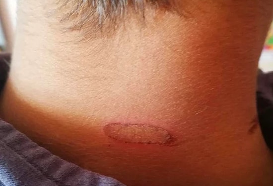 Bunu da Gördük: Öğretmen, Kızgın Soba Maşasını Öğrencilerin Vücuduna Bastı...