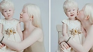12 Yıl Arayla Doğan Albino Kız Kardeşlerden Farklı Olmanın da Güzel Olduğunu Kanıtlayan Fotoğraflar
