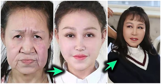 Genetik Bir Rahatsızlık Nedeniyle 60 Yaşında Gözüktüğü İçin Zorbalığa Maruz Kalan Genç Kızın Muazzam Değişimi!