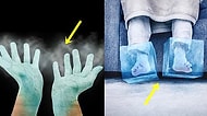 Asla Isınmayıp Sürekli Üşüyen El ve Ayaklarınız Ciddi Rahatsızlıkların Belirtisi Olabilir!