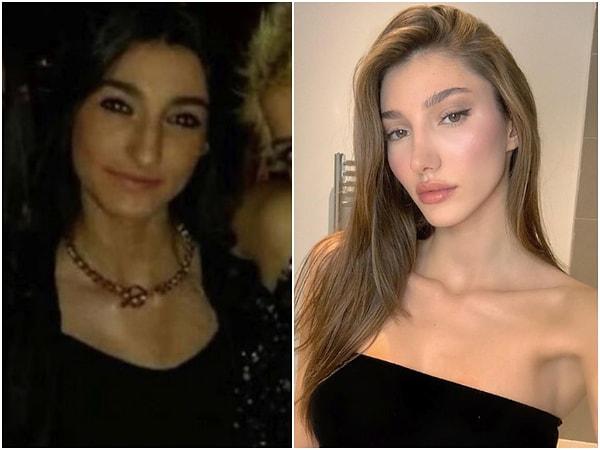 11. 2018 Miss Türkiye'de 1. olan Şevval Şahin'in estetik operasyonları, o dönem pek bir konuşulmuştu.
