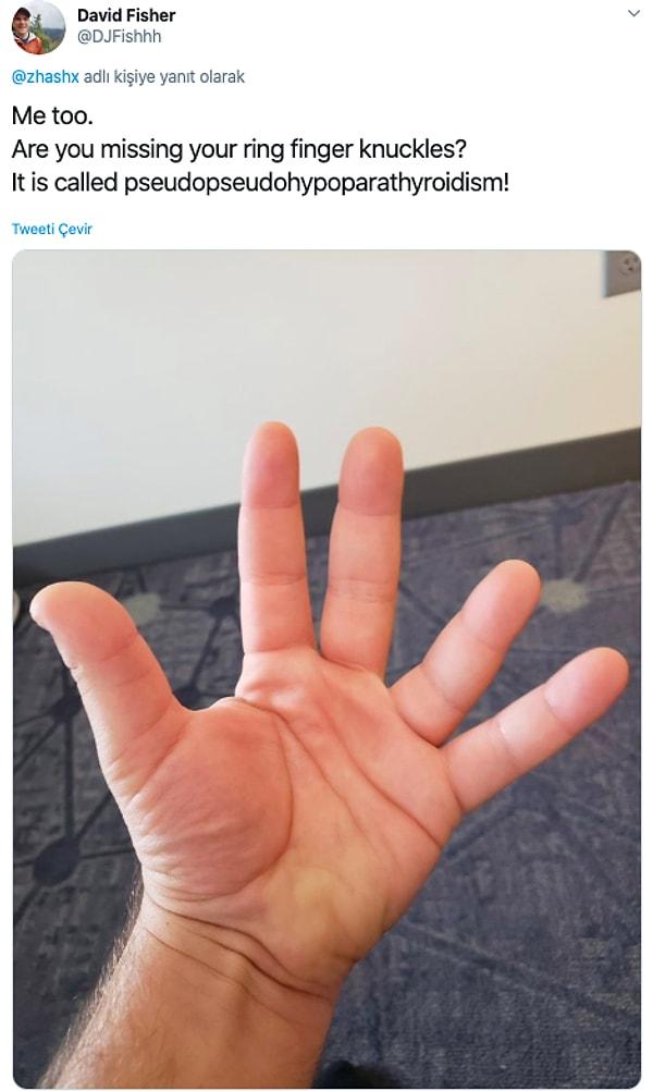 2. Bu tweet'in ardından parmakları Zahra gibi olan birçok insan kendi ellerinin fotoğrafını paylaştı 👇