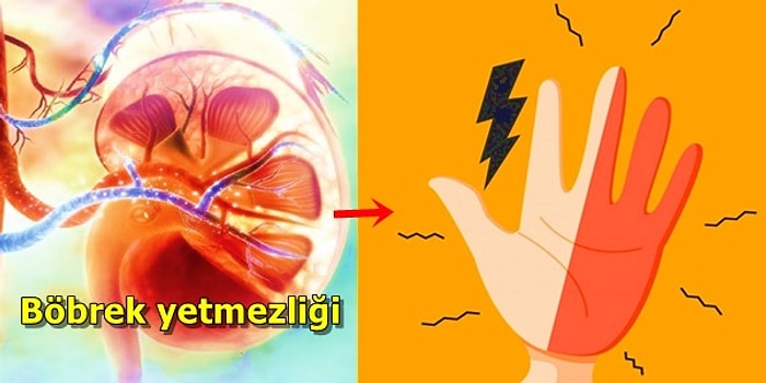 Ellerimiz ve Ayaklarımız Neden Uyuşur ve Karıncalanır?