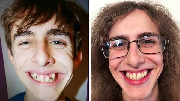 16. "2 yıl, 11 ay ve 20 gün süren diş tedavisinin sonucu. Her saniyesine değerdi!"