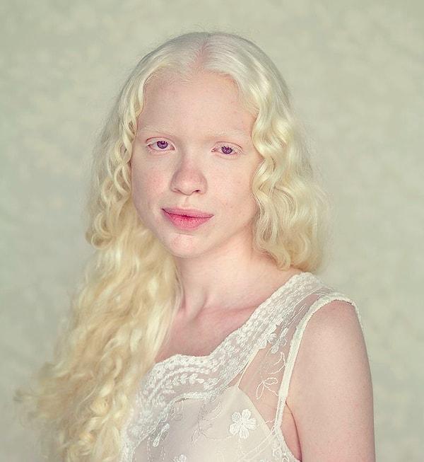 19. Albino olan insanların gözleri genelde bu renk oluyormuş, rengi de tam çözemedik ❤️