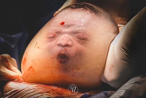 8. Geçen yıl oldukça uzun bir süre etkisinden çıkamadığımız, bebeğin hala amniyotik sıvının içerisinde olduğu fotoğraf 👇
