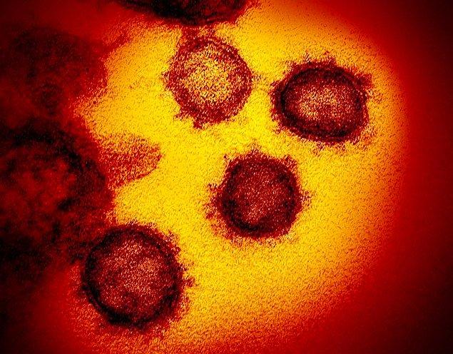 Haftaya tüm dünyayı etkisi altına alan bir haberle başlayalım... ABD’de corona virüsünün yeni görüntüsü yayınlandı!