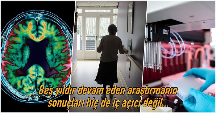 Alzheimer Tedavisi İçin Kullanılan Bazı İlaçların Hastalığı Yavaşlatmada Etkili Olmadığı Ortaya Çıktı