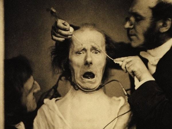 11. Fransız nörolog Duchenne de Boulogne'nin medikal çalışmaları sırasında çekilen fotoğraf: