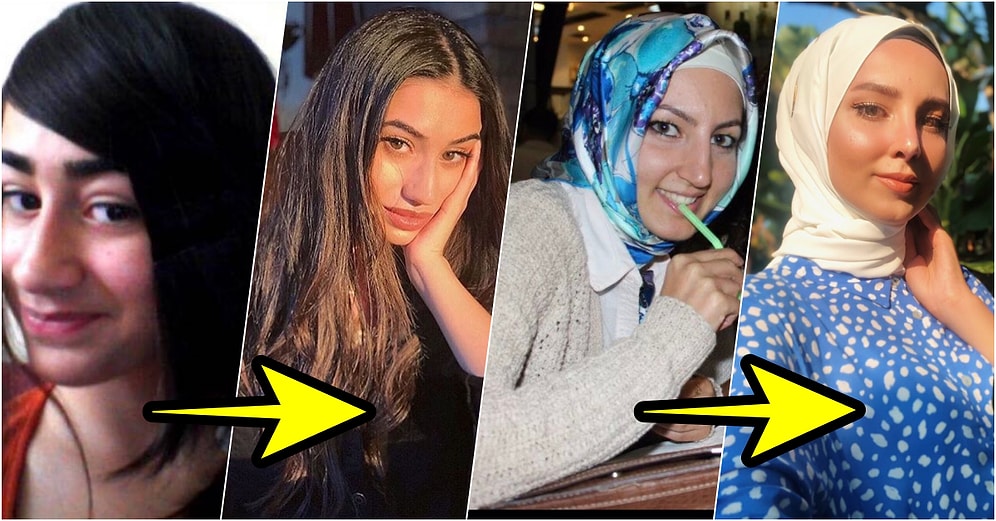 Plastik Cerrahinin Sadece Bir Tıp Alanı Değil Aynı Zamanda Bir Sanat Dalı Olduğunu Kanıtlayan 25 Mucizevi Değişim