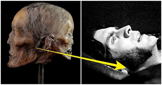 Başının Arkasında Taşıdığı 'Şeytani İkizi'ne Ait Yüzün Fısıltılarıyla Delirdiği Düşünülen Ürkütücü Bir İngiliz Asilzadesi: Edward Mordrake