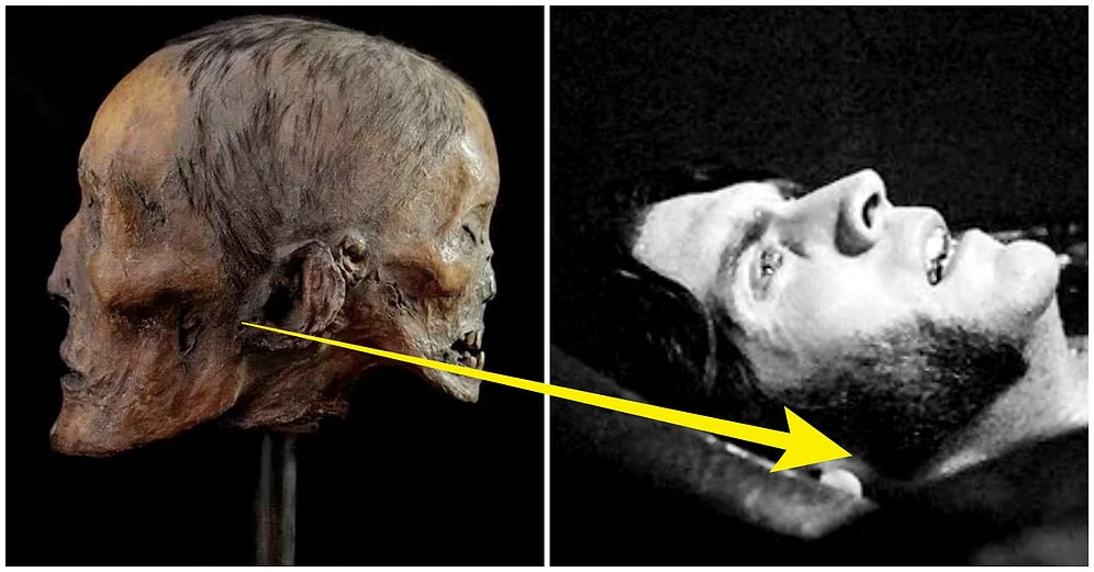 Başının Arkasında Taşıdığı 'Şeytani İkizi'ne Ait Yüzün Fısıltılarıyla Delirdiği Düşünülen Ürkütücü Bir İngiliz Asilzadesi: Edward Mordrake