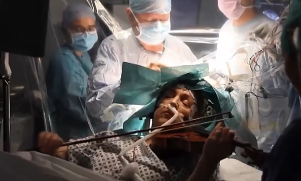 В Великобритании впервые в мире состоялась операция человеку, играющему на скрипке во время процедуры..