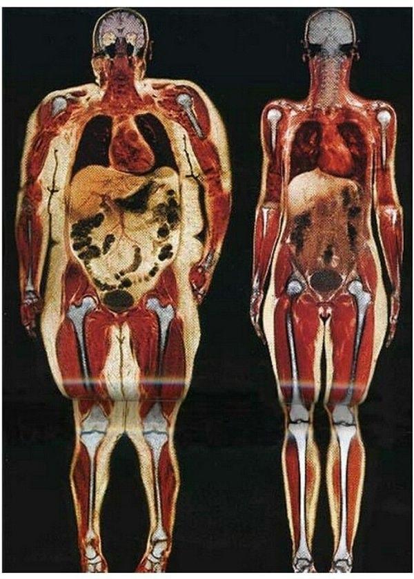 13. 110 kilo bir kadın ile 55 kilo olan kadın arasındaki fark