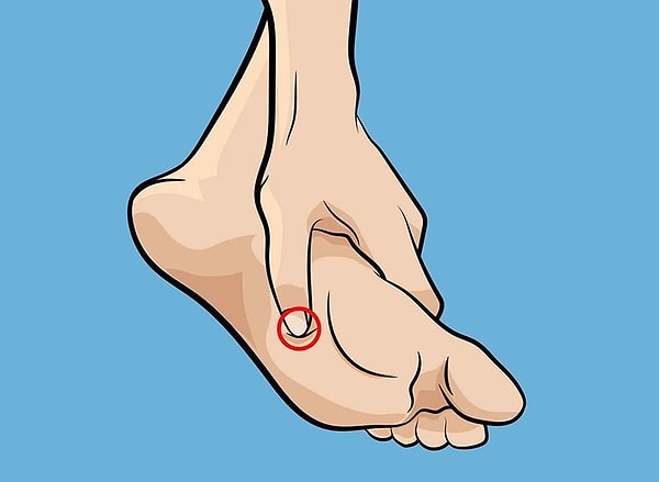 8. Точка 'Yongquan'