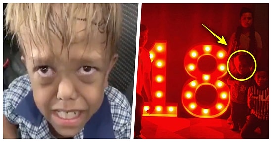 Gördüğü Zorbalıktan Dolayı Kendini Öldürmek İsteyen Quaden Bayles'in 18 Yaşında Olduğu İddia Edildi!