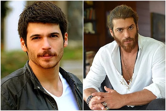 12 турецких знаменистостей до и после смены имиджа