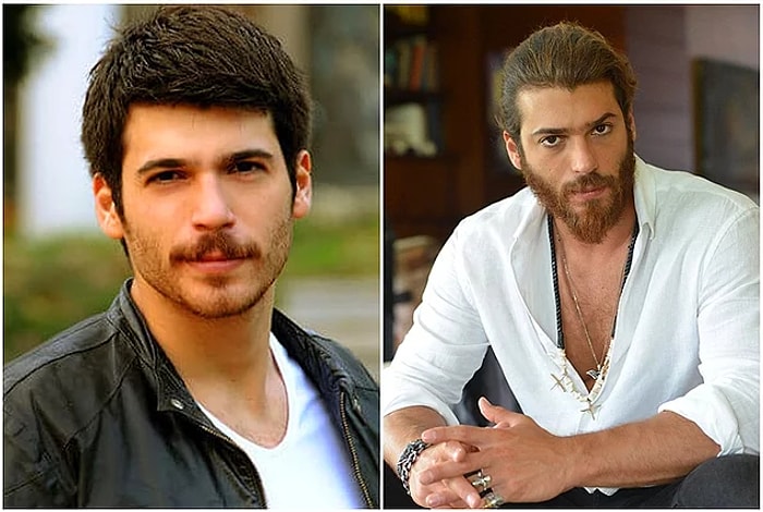 12 турецких знаменистостей до и после смены имиджа