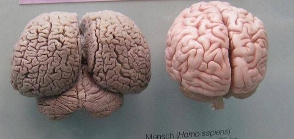 14. Soldaki bir yunusa ait, sağdaki ise insan beyni.