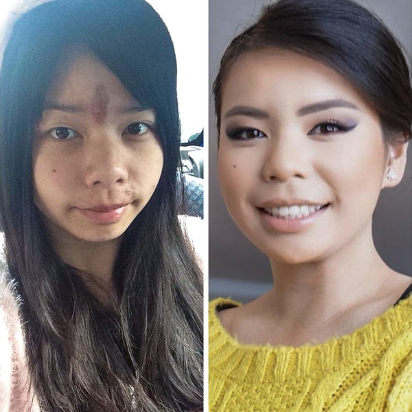 "За день до моей свадьбы сестра сожгла мне кожу на лбу, когда пыталась сделать восковую эпиляцию на брови. Мне повезло, что она хорошо делает макияж и смогла спасти ситуацию."