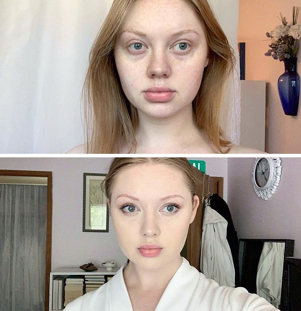 "Наконец, я нашла способ скрыть свои темные круги под глазами!"