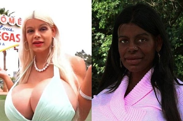 1. Estetikle ırk değiştirmek deyince akla artık sadece Alman fenomen Martina Big gelmiyor.