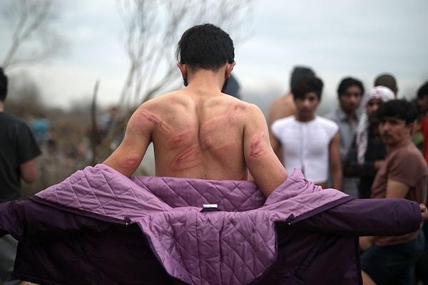 Sınırı geçmeyi başaran göçmenlerin birçoğu Yunan güvenlik güçlerince yakalanarak Türkiye tarafına geri gönderiliyor. Dövülerek ve kıyafetleri alınarak geri gönderilen o göçmenlerin fotoğraflarını Anadolu Ajansı paylaştı 📸