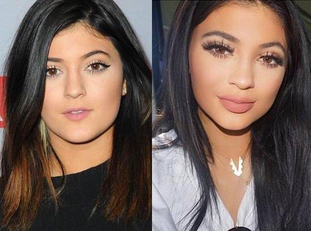2. Kylie Jenner geçirdiği onlarca operasyonun ardından ergenlik hallerinden bile genç bir görünümü yakaladı.